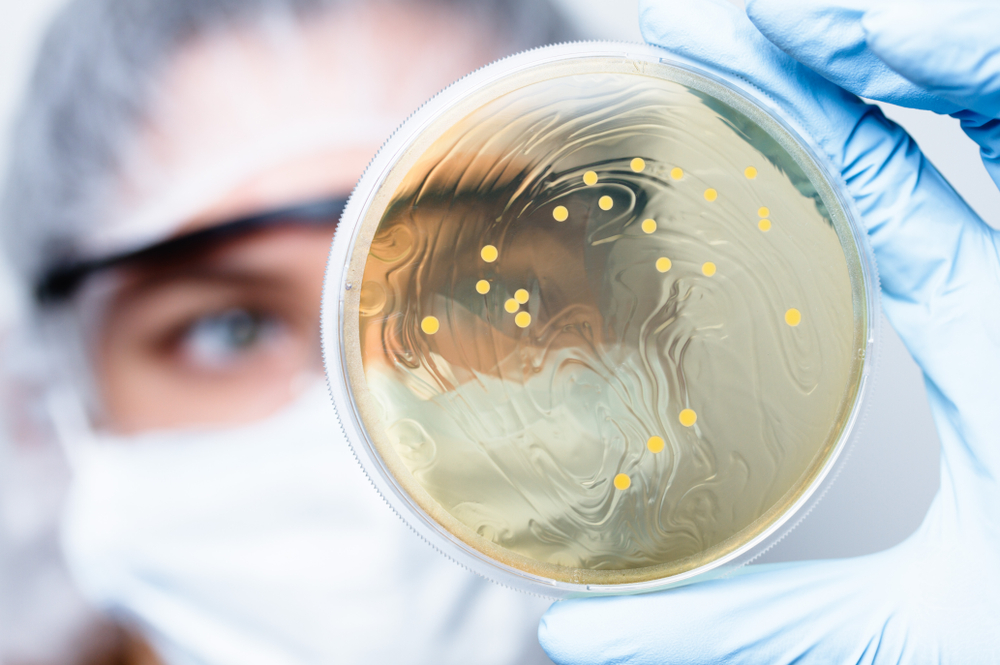 3 bonnes raisons de faire appel à un façonnier spécialisé dans les probiotiques.